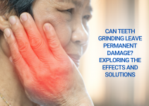 Can Teeth Grinding Leave Permanent Damage? Exploring the Effects and Solutions